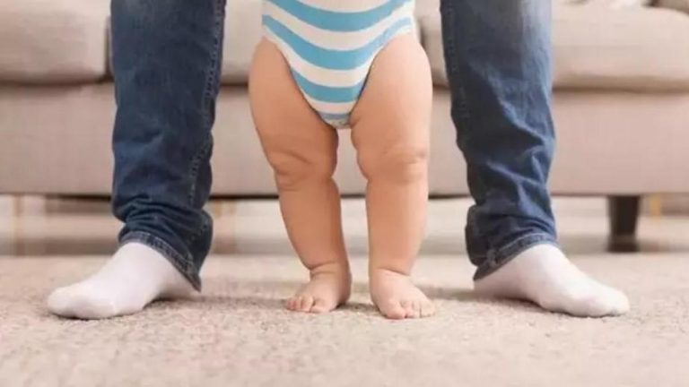 ÇOCUKLARDA YÜRÜMEK SORUN MUDUR?